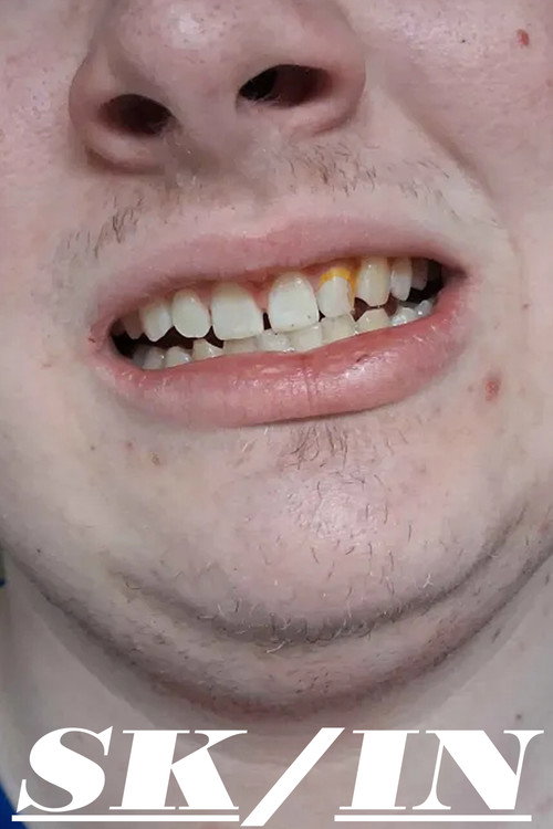 Skin (2026) - film poster