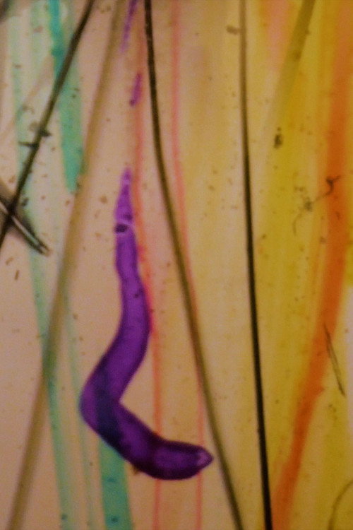 Visions From My Scalp (2023) — film poster, directed by Mark Chua