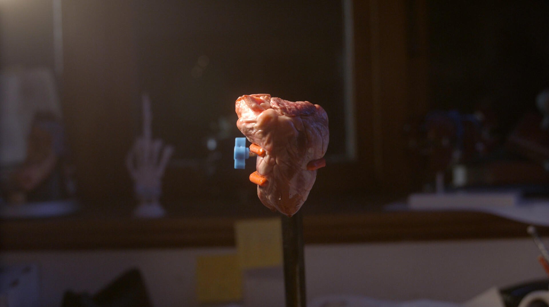 Surgical Precision