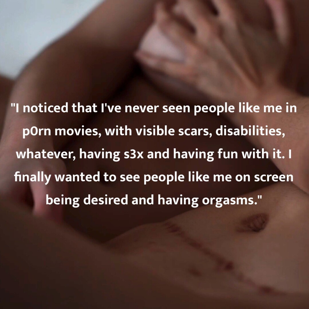SCARS