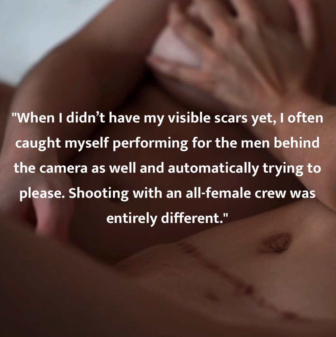 SCARS