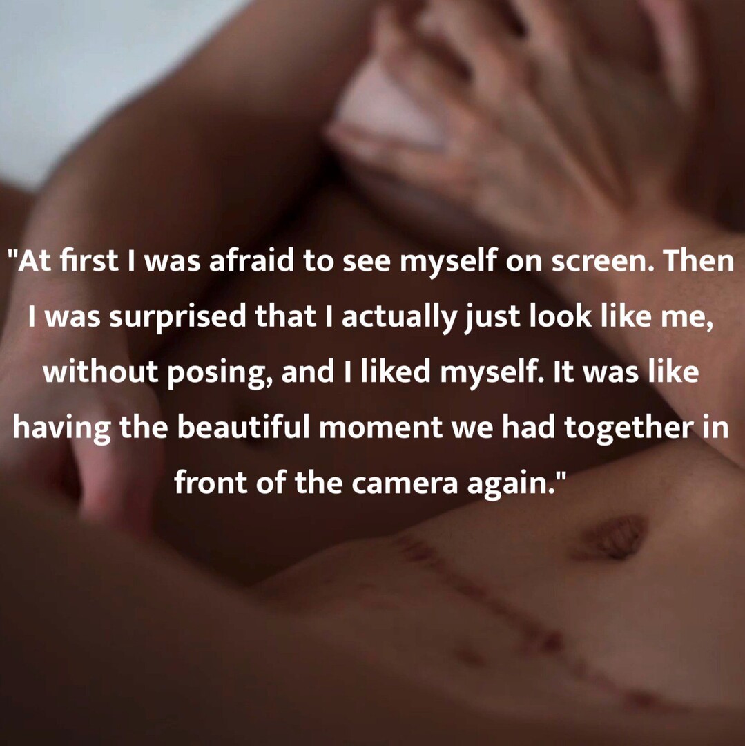 SCARS