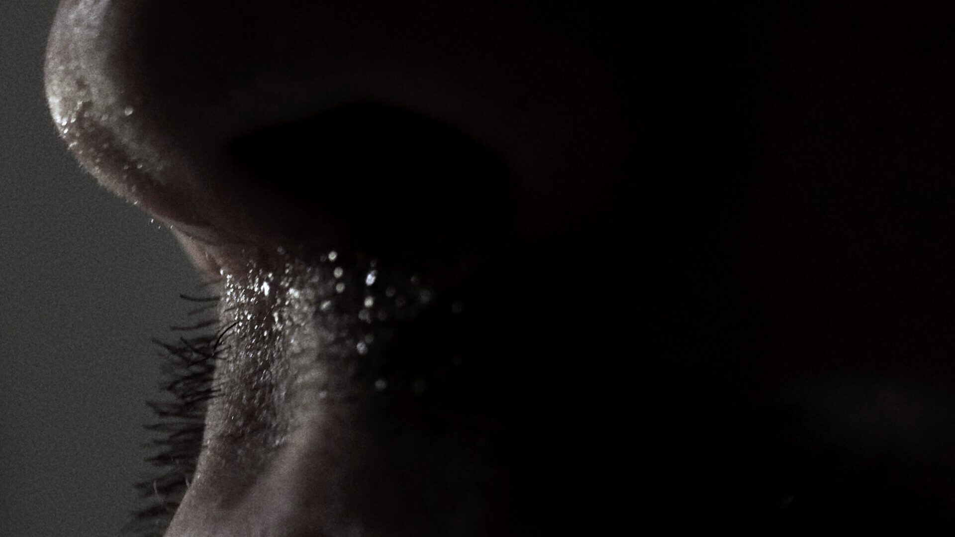 SNOT