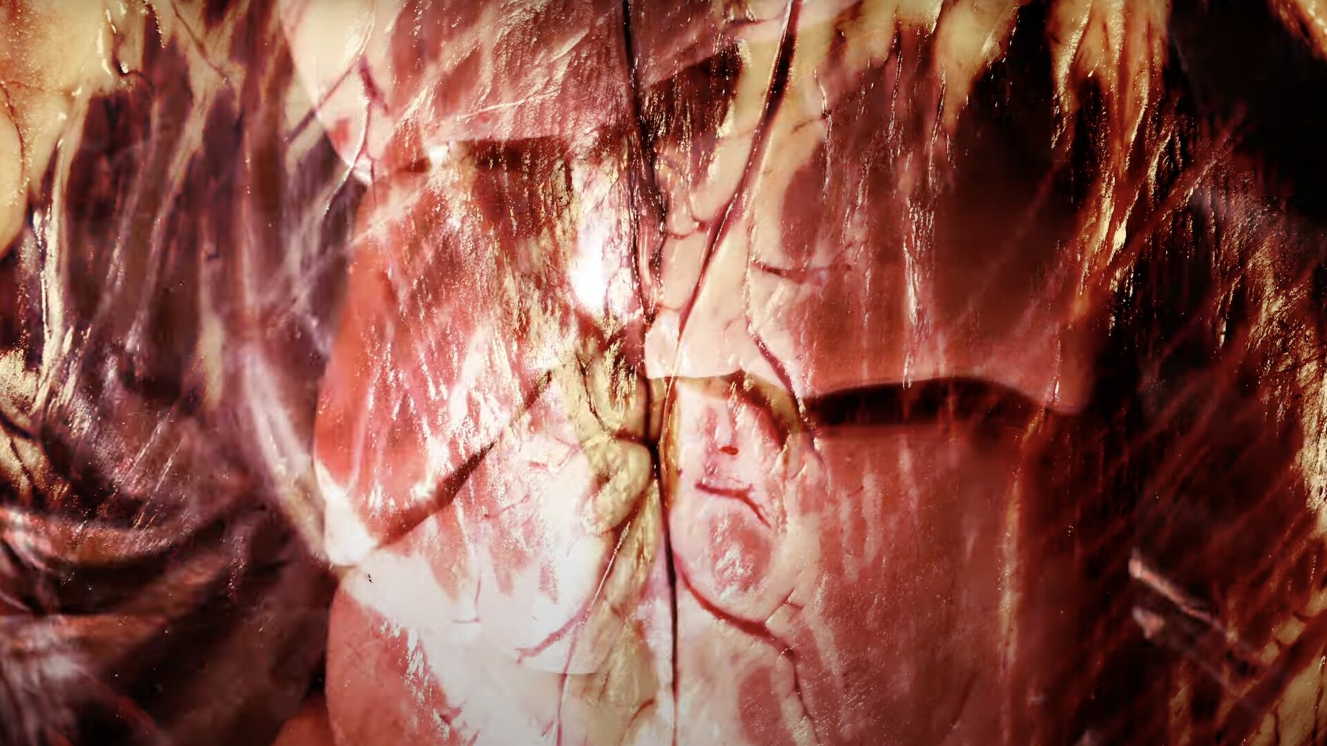 Visceral