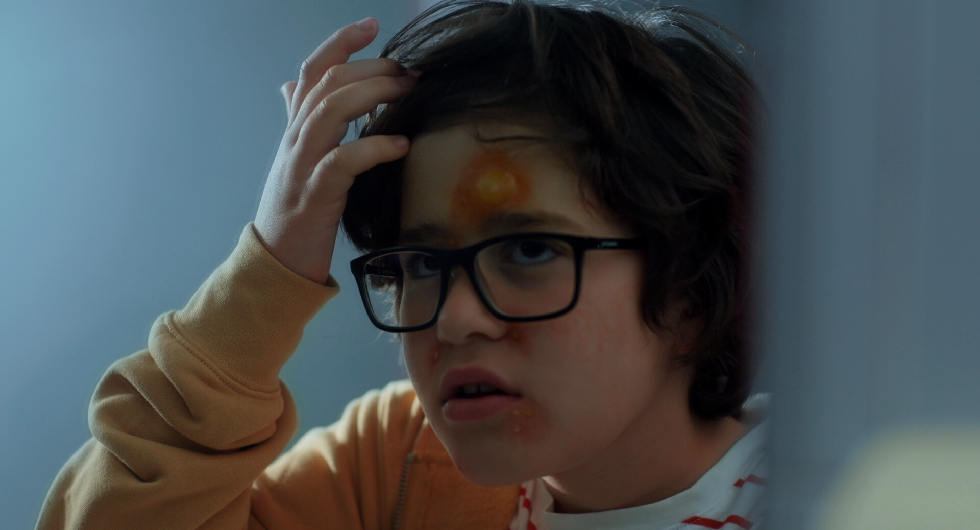 Pimple