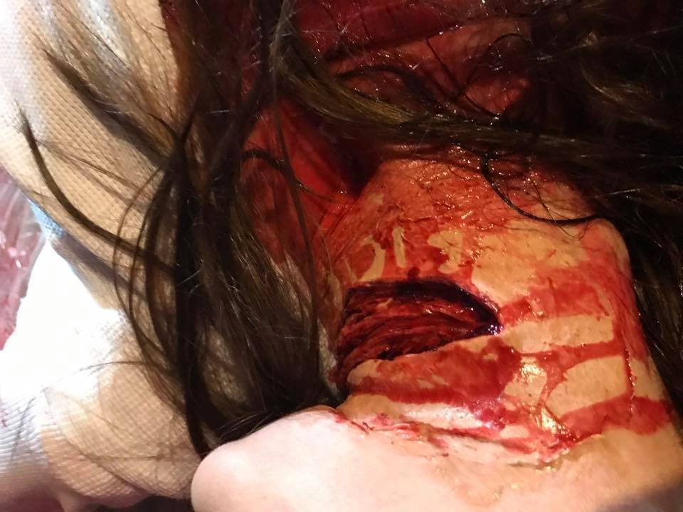 Mutilation Massacre