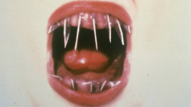 Le Dentiste 2